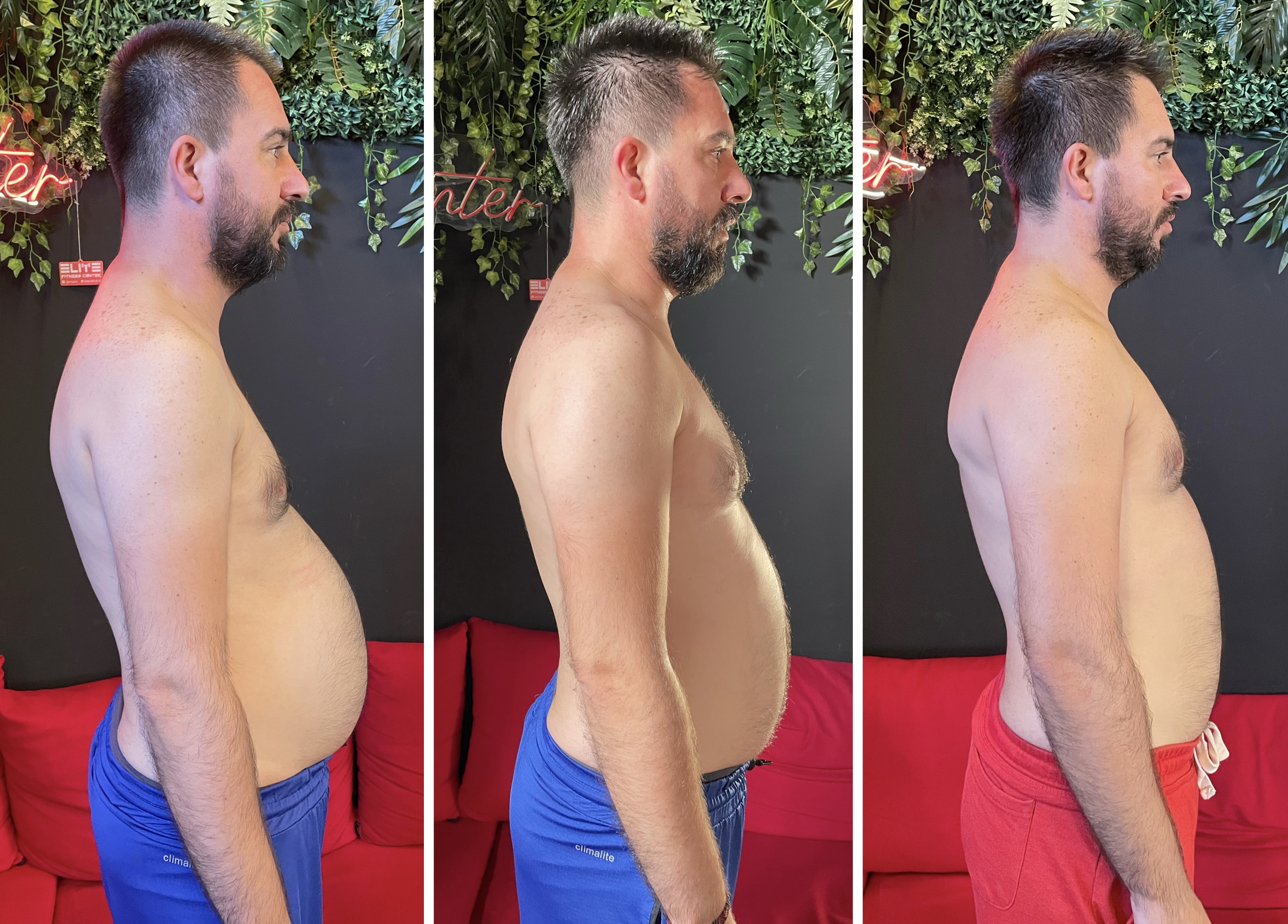 Before After Transformation 15